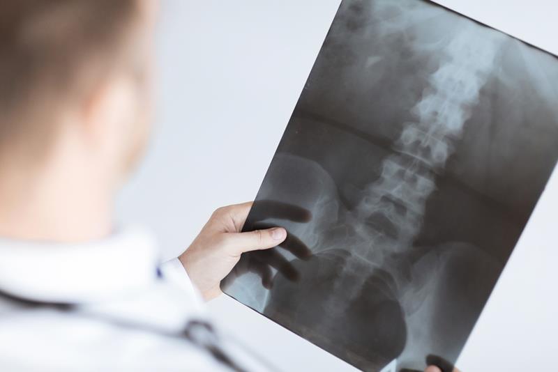 X-Rays Naples, FL